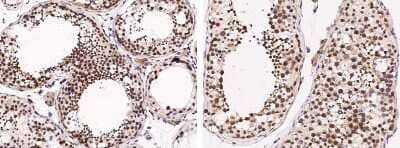 Immunohistochemistry-Paraffin: DZIP1 Antibody [NBP2-98687]