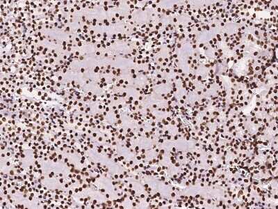 Immunohistochemistry-Paraffin: DZIP1 Antibody [NBP2-99579]