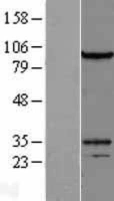 Western Blot: DZIP1L Overexpression Lysate [NBL1-10082]