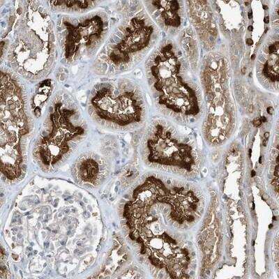 Immunohistochemistry-Paraffin: DZIP3 Antibody [NBP1-81698]