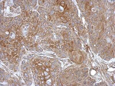Immunohistochemistry-Paraffin: DZIP3 Antibody [NBP2-16248]
