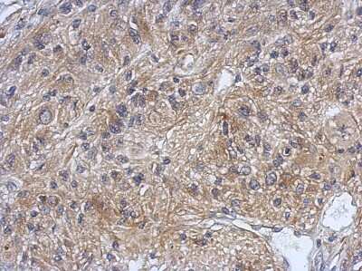 Immunohistochemistry-Paraffin: DZIP3 Antibody [NBP2-16249]