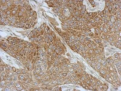 Immunohistochemistry-Paraffin: DZIP3 Antibody [NBP2-16250]