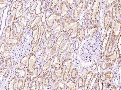 Immunohistochemistry-Paraffin: DZIP3 Antibody [NBP2-97549]