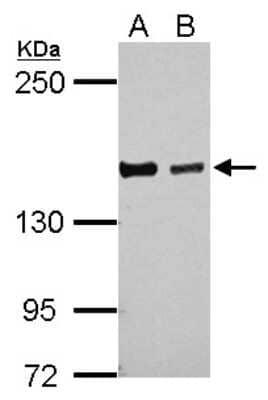 Western Blot: DZIP3 Antibody [NBP2-16248]