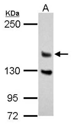 Western Blot: DZIP3 Antibody [NBP2-16249]