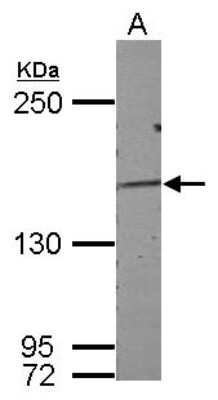 Western Blot: DZIP3 Antibody [NBP2-16249]