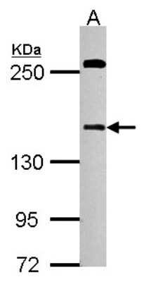 Western Blot: DZIP3 Antibody [NBP2-16250]