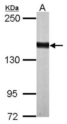 Western Blot: DZIP3 Antibody [NBP2-16250]