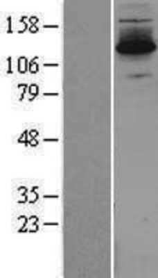 Western Blot: DZIP3 Overexpression Lysate [NBL1-10083]