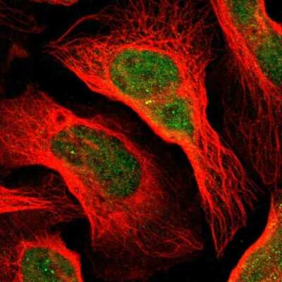 Immunocytochemistry/ Immunofluorescence: Dact1 Antibody [NBP1-85308]