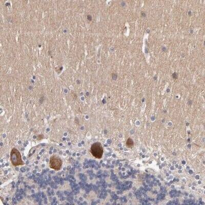 Immunohistochemistry-Paraffin: Dact1 Antibody [NBP1-85308]