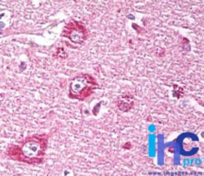 Immunohistochemistry-Paraffin: Dact1 Antibody [NBP2-24768]