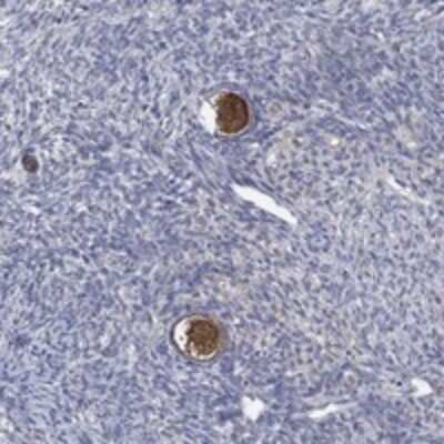 Immunohistochemistry-Paraffin: Dact1 Antibody [NBP3-17785]