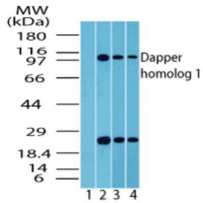 Western Blot: Dact1 Antibody [NBP2-24768]