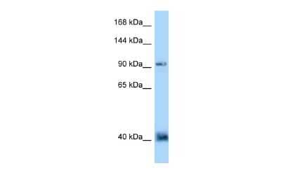 Western Blot: Dact1 Antibody [NBP2-84757]