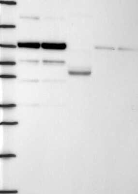 Western Blot: Dact1 Antibody [NBP3-17785]