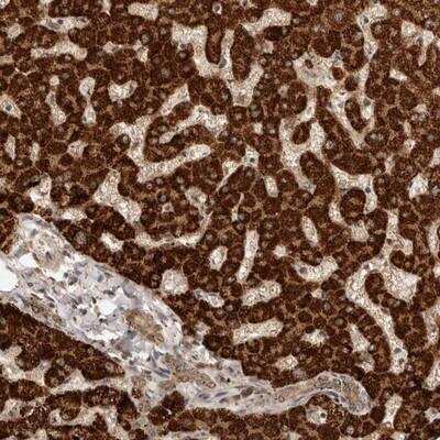 Immunohistochemistry: Dact2 Antibody [NBP1-88755]