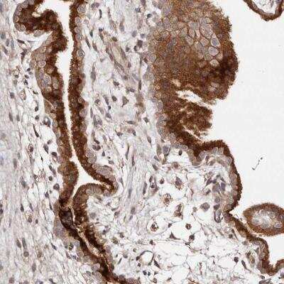 Immunohistochemistry-Paraffin: Dact2 Antibody [NBP1-88756]