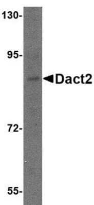 Western Blot: Dact2 AntibodyBSA Free [NBP1-76955]