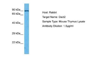 Western Blot: Dact2 Antibody [NBP2-87244]