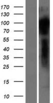 Western Blot: Dact2 Overexpression Lysate [NBP2-04461]