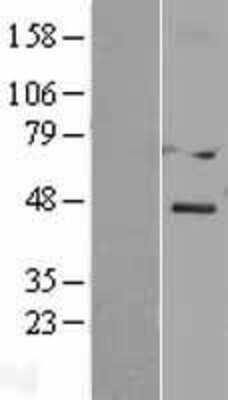 Western Blot: DACT3/Dapper 3 Overexpression Lysate [NBL1-09712]