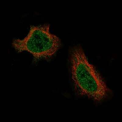 Immunocytochemistry/ Immunofluorescence: Daxx Antibody (CL3580) [NBP2-61622]