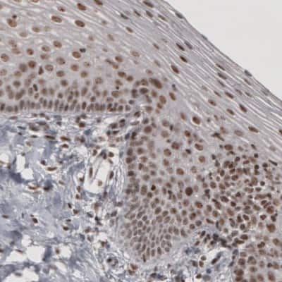 Immunohistochemistry: Daxx Antibody (CL3580) [NBP2-61622]