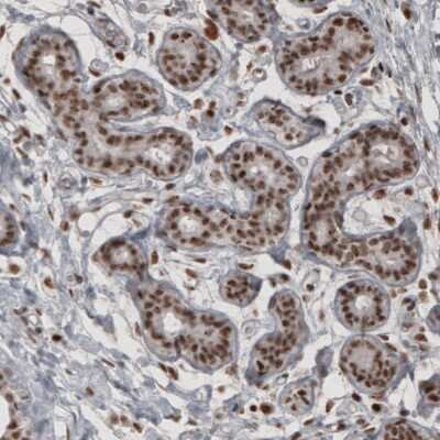 Immunohistochemistry: Daxx Antibody (CL3580) [NBP2-61622]