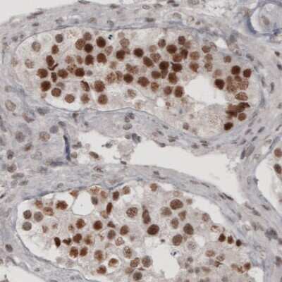 Immunohistochemistry: Daxx Antibody (CL3580) [NBP2-61622]