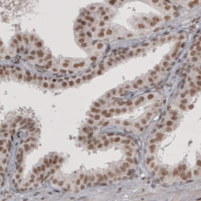 Immunohistochemistry: Daxx Antibody (CL3580) [NBP2-61622]