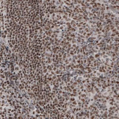 Immunohistochemistry-Paraffin: Daxx Antibody (CL3580) [NBP2-61622]