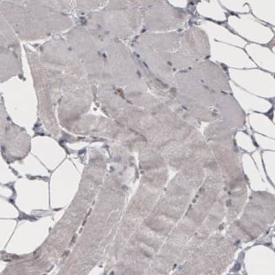 Immunohistochemistry-Paraffin: Daxx Antibody (CL3580) [NBP2-61622]