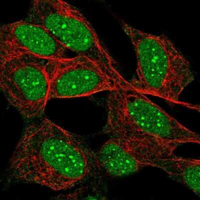 Immunocytochemistry/ Immunofluorescence: Daxx Antibody [NBP2-56390]