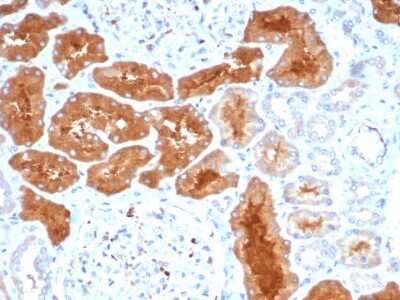 Immunohistochemistry-Paraffin: Daxx Antibody (PCRP-DAXX-8C2) - Azide and BSA Free [NBP3-08741]