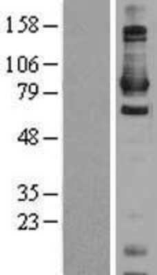 Western Blot: Daxx Overexpression Lysate [NBL1-09722]