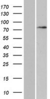 Western Blot: Daxx Overexpression Lysate [NBP2-09623]