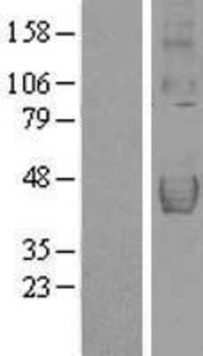 Western Blot: TRAILR4/TNFRSF10D/DcR2 Overexpression Lysate [NBL1-17144]