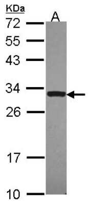 Western Blot: DcR3/TNFRSF6B Antibody [NBP2-16112]