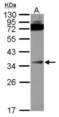 Western Blot: DcR3/TNFRSF6B Antibody [NBP2-16113]