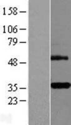 Western Blot: DcR3/TNFRSF6B Overexpression Lysate [NBL1-17158]