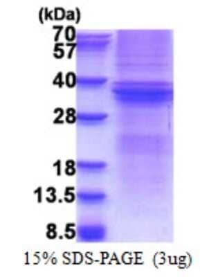 SDS-PAGE: Recombinant Human DcR3/TNFRSF6B His Protein [NBP2-22907]