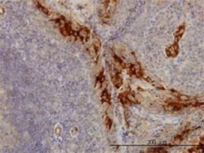 Immunohistochemistry-Paraffin: DcR3/TNFRSF6B Antibody (7G5) [H00008771-M02]