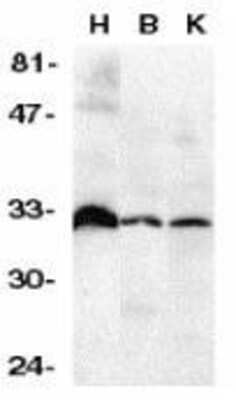 Western Blot: DcR3/TNFRSF6B AntibodyBSA Free [NBP1-76909]