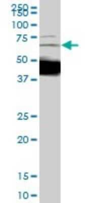 Western Blot: Dcp1a Antibody (2D12) [H00055802-M01]