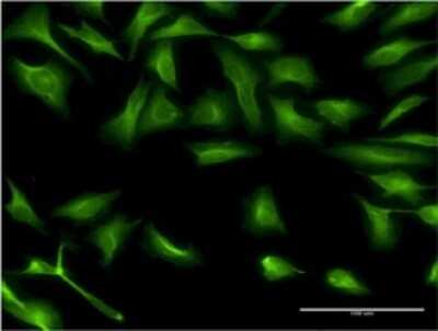 Immunocytochemistry/ Immunofluorescence: Dcp1a Antibody (2F11) [H00055802-M02]