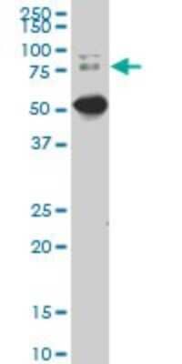 Western Blot: Dcp1a Antibody (2F11) [H00055802-M02]