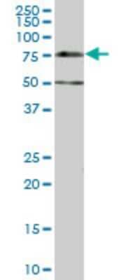 Western Blot: Dcp1a Antibody (2G10) [H00055802-M07]