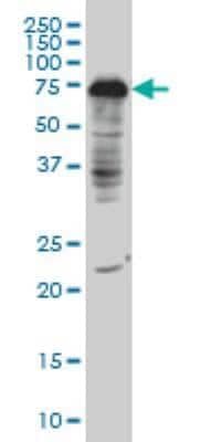 Western Blot: Dcp1a Antibody (3G4) [H00055802-M06]